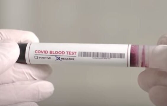 Антитела не помеха повторному заражению коронавирусом